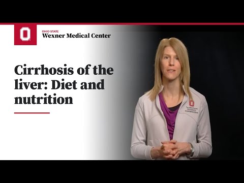 Cirrhosis of the liver: Diet and nutrition | Ohio State Medical Center
