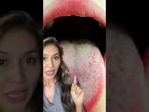 Tip to Get Rid of Stinky Bad Breath