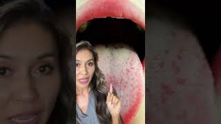 Tip to Get Rid of Stinky Bad Breath