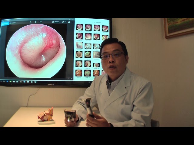 منظار الأذن بالفيديو SyncVision iO1 OTO