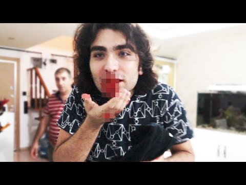 HIRSIZ ŞAKASI YAPARKEN DAYAK YEDİM (Burnum Kırıldı)