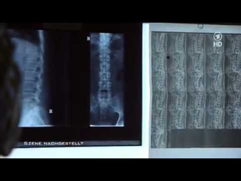 ARD: Vorsicht Operationen--die story im ersten