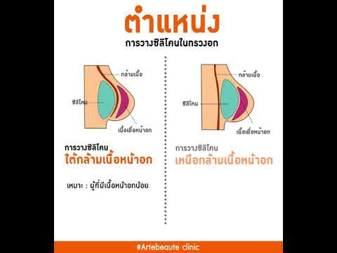 ความคิดเห็นในการเสริม Novosibirsk หน้าอกเล็กสาวผอมมาก