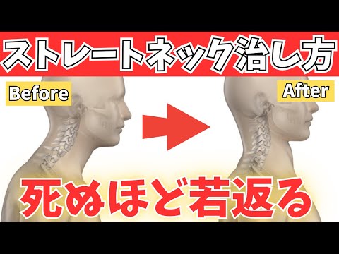 [So heilen Sie einen geraden Hals] Verjüngen Sie Ihr Gesicht und Ihre Haltung wirklich! Nackenversch