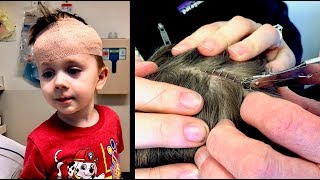 HEAD STAPLE REMOVAL GONE WRONG!  | Dr. Paul