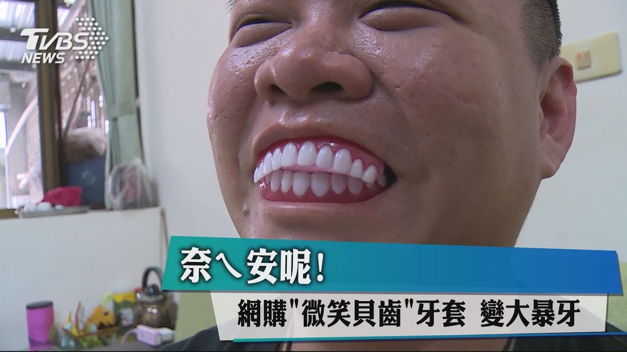 奈ㄟ安呢！網購「微笑貝齒」牙套　變大暴牙