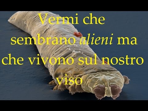 Eruzione della pelle da parassiti I vermi firmano ad adulti