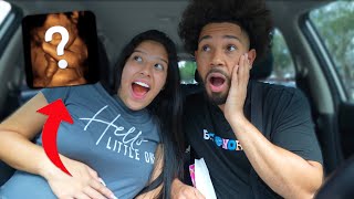 FINALLY SEEING OUR BABY!! *4D ULTRASOUND RE-SCAN*