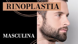 Rinoplastia Masculina - Os Detalhes Da Plástica No Nariz Em Homens - Dr. Fábio Maniglia