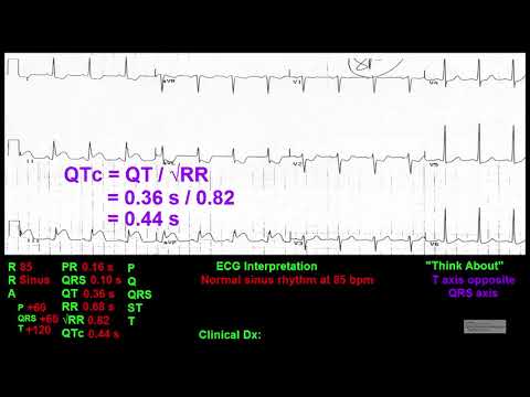 online ecg interpretation course samples