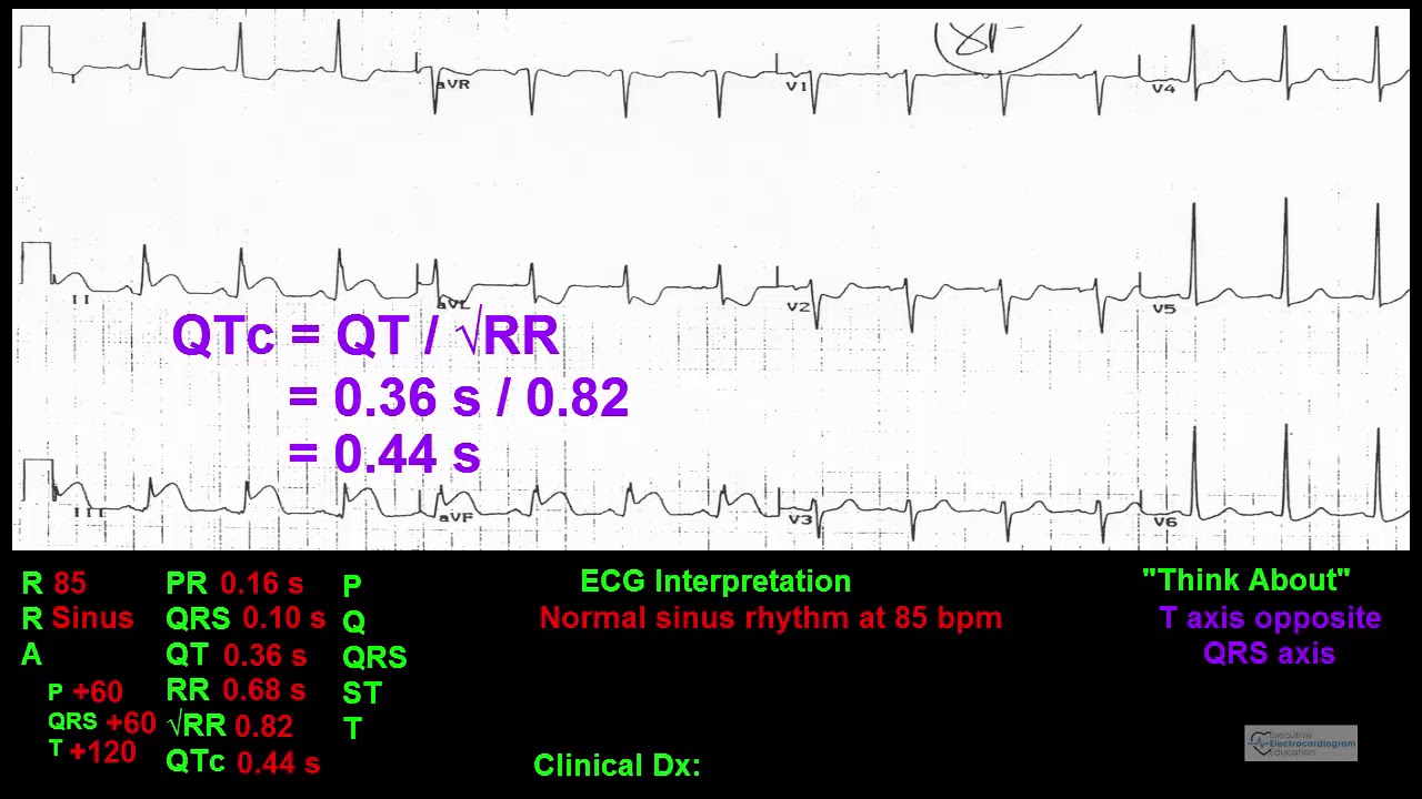 Executive Electrocardiogram Education - Guidelines To ECG Interpretation Preview Video