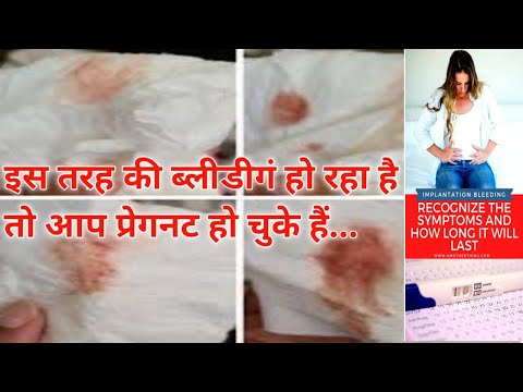 Implantation bleeding vs periods।।इम्प्लांटेशन ब्लीडिंग क्या है, कब होती है, कितने दिन तक होती है।