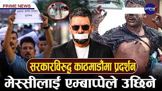 आ*त्मदा*ह प्रयास गरेका गणेश नेपालीको स्वास्थ्यवस्था चिन्ताजनक, दिल्ली लग्ने योजना तत्काललाई स्थगित