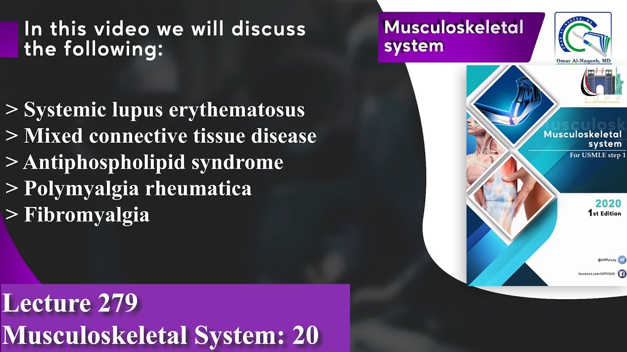 Systemic lupus erythematosus | Antiphospholipid syndrome | Polymyalgia rheumatica | Fibromyalgia