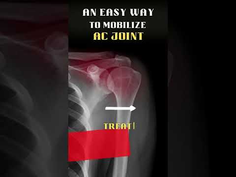 TMJ MOBILIZATION TECHNIQUES FOR JAW PAIN STIFFNESS SHORTS REELS