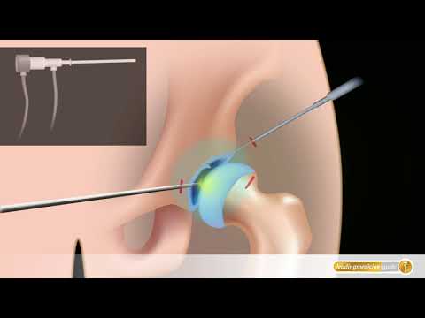 Bauchtanz Thorax Behandlung von Wirbelsäulen neuromas