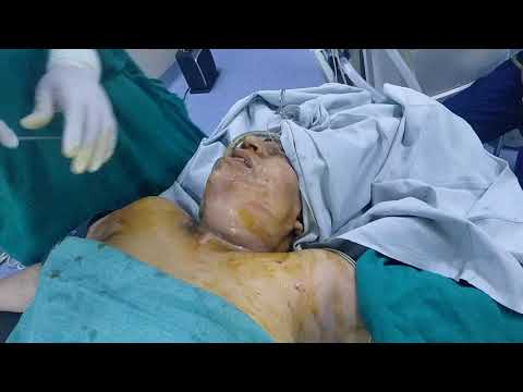 Patient Recovery Case — Video 26 (Clinical Testimonial)