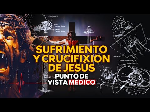 SUFRIMIENTO Y CRUCIFIXION DE JESÚS: Punto de vista medico