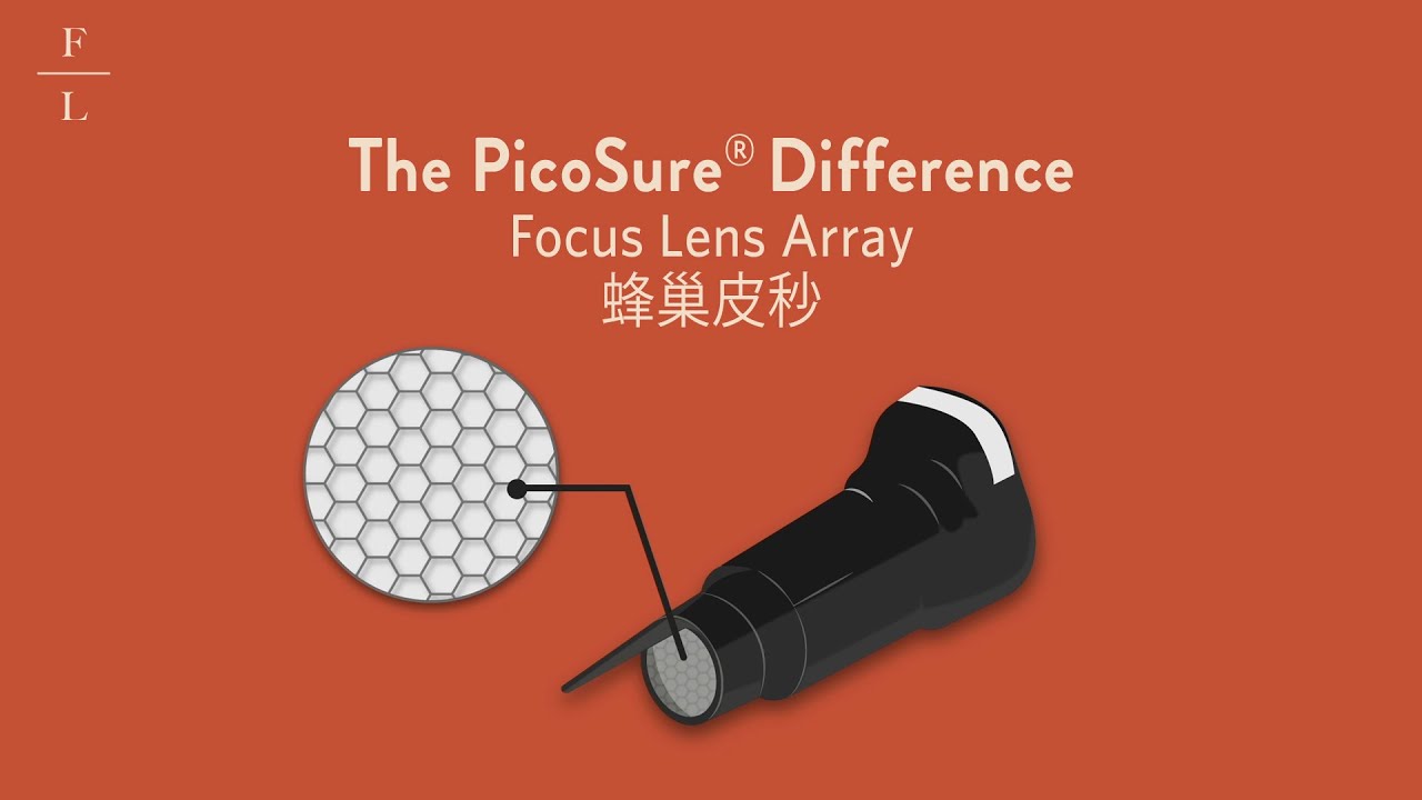 The PicoSure Difference: Focus Lens Array