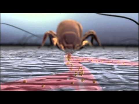 Kiefergelenk Anomalie Gymnastik für Halsschmerzen Video