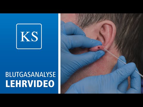 Lehrvideo | Blutgasanalyse