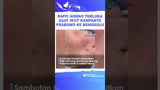 Sangat Antusias! Momen Raffi Ahmad Ikut Kampanye Capres Prabowo, Tangannya Terluka Kena Cakar Warga