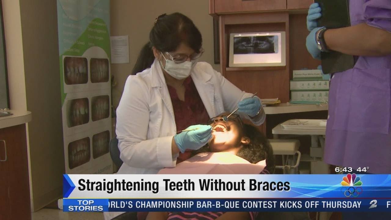 How can I straighten my teeth without a dentist?