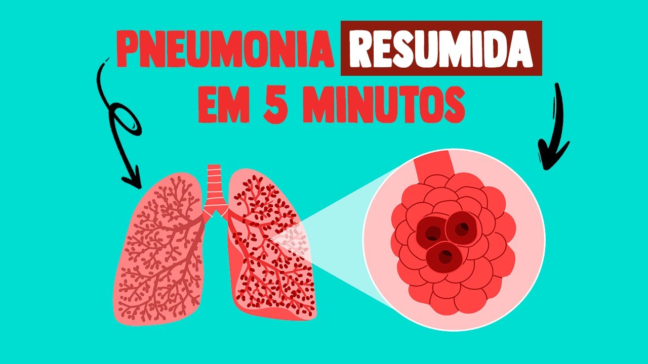 Pneumonia em 5 minutos │ MEDICINA RESUMIDA