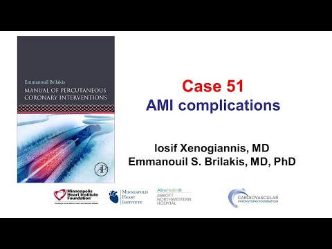 Case 51: PCI Manual - MI complications