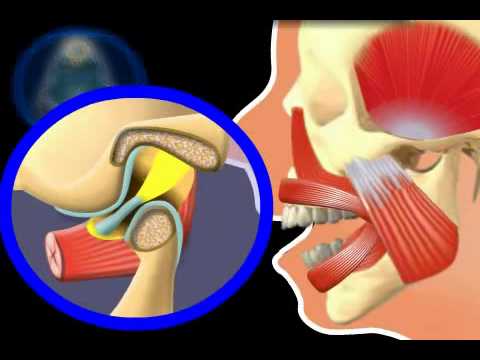 Das kann mit Schmerzen im unteren Rücken genommen werden Kohlblatt mit Honig mit Arthrose des Kniegelenks