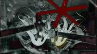 Metric - Help! I&#39;m Alive