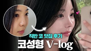 직반 코 변신! 너무 예뻐서 자기 전에 생각 많이 날 거야 | 코성형 브이로그