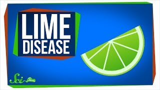 Lime Disease: How a Fruity Drink Can Give You a Rash