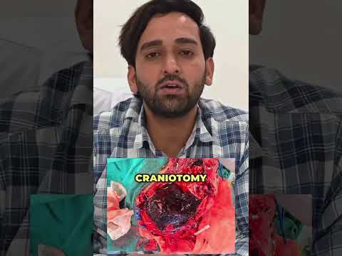 Warning signs short by Dr. Tushar Sharma