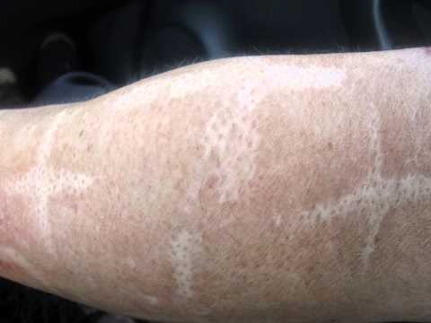 Affronti il pacco con laminarias e argilla Grasso per la pelle di faccia di maschera nutriente