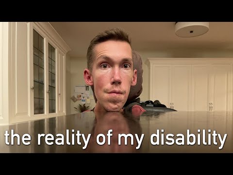 What is wrong with Shane’s voice? / Squirmy and Grubs