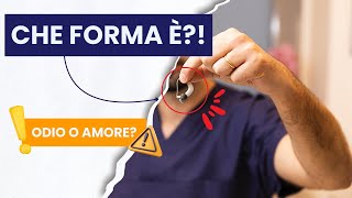 Widex Moment SmartRIC: flop o rivoluzione?