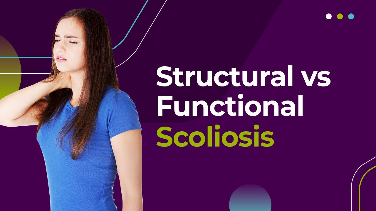 Structural vs Functional Scoliosis