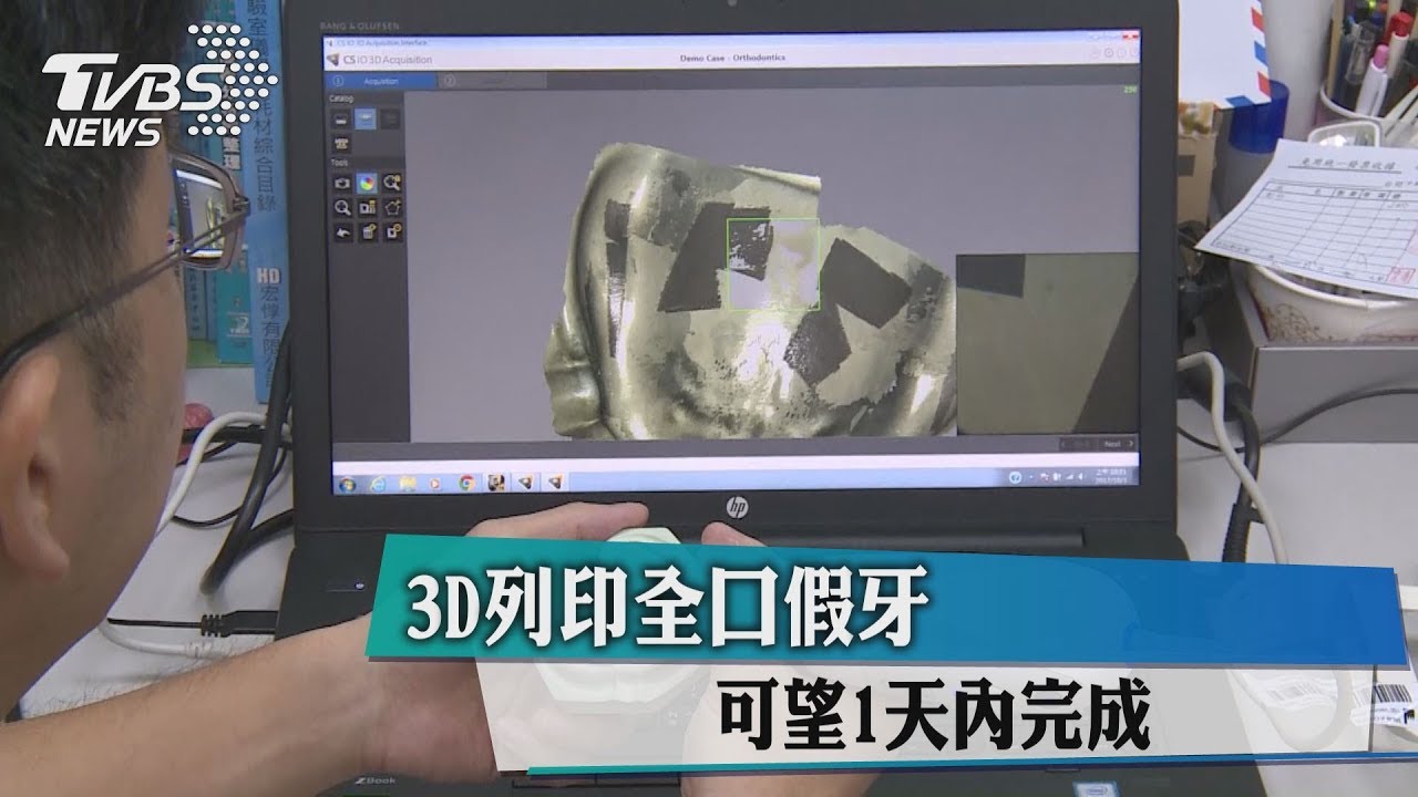 3D列印全口假牙 可望1天內完成