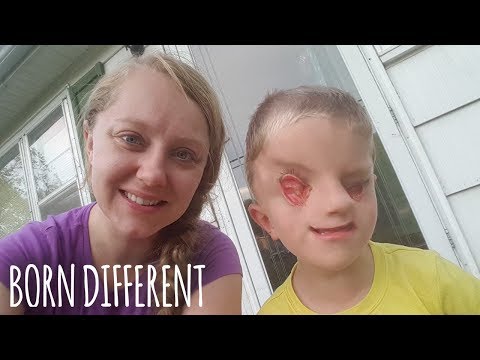 My Incredible Son With No Eyes | BORN DIFFERENT