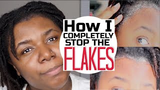 How To COMPLETELY Stop Dry/Flaky Scalp in 2023| UPDATED Scalp Routine | Starter Locs