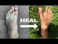 How Barefoot Training Heals The Body