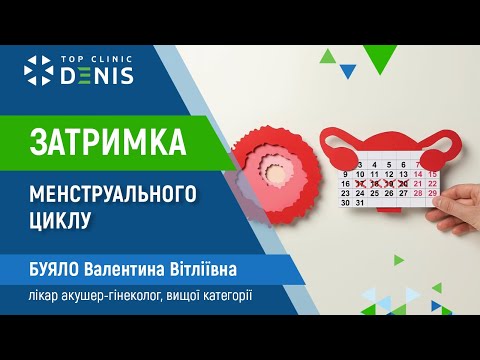 Задержка менструального цикла у подростков - TOP Clinic DENIS