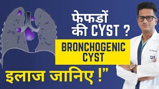Bronchogenic Cyst क्या होती है? लक्षण, कारण और सर्जरी | Dr Kamran Ali