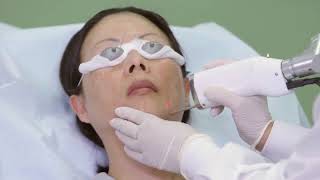 Melasma Treatment Video