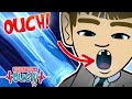 @Operation Ouch - Broken Bones and Busted Teeth! | Science for Kids
