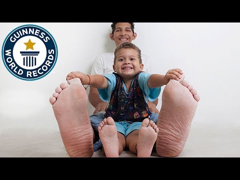 image-What is the biggest foot size ever?