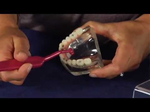 TePe Interdental Brushes - Proper Care for Dental Implants