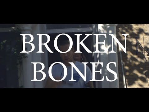 Broken Bones - Rob Lynch