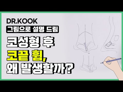 [그림설명] 코 성형 후 생기는 코끝변형 왜 발생할까?!